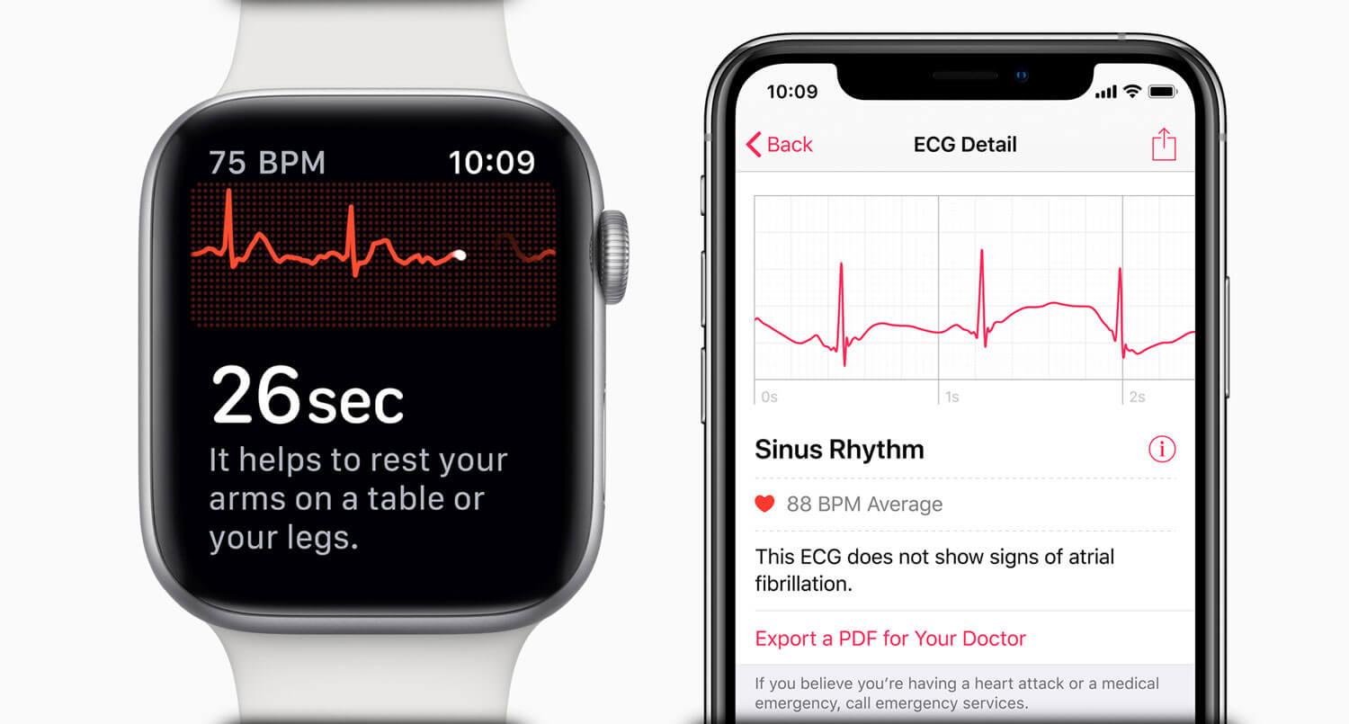 ECG Apple Watch