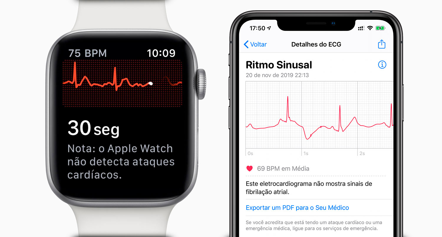 ECG Apple Watch