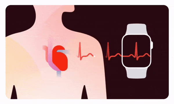 ECG no Apple Watch