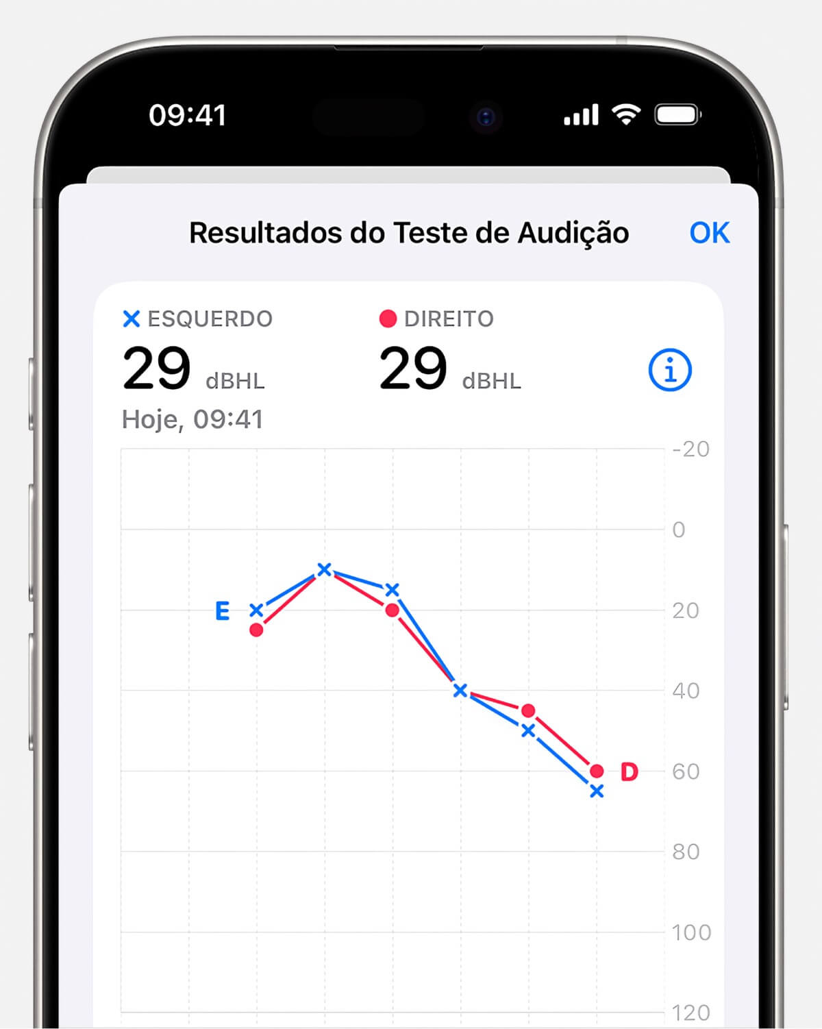 teste audicao detalhes » Blog do iPhone